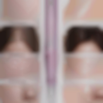 Омолоджує шкіру, зменшує зморшки,рубці,постакне