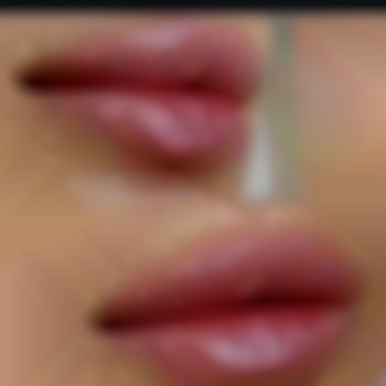 Збільшення Філер