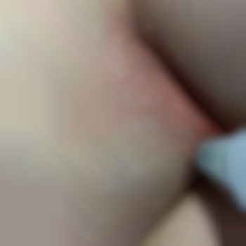 Так отмирают луковицы