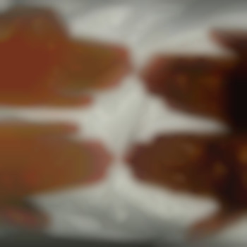 Фото з портфоліо фахівця Олександр Хорольський (пластичний хірург, Херсон)