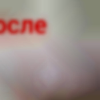 Глубокое бикини
                    Майстер депіляції Олександра Палагіцька Черкаси