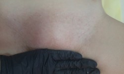 Депіляція Бікіні Косметолог-естетист Наталья Черкаси