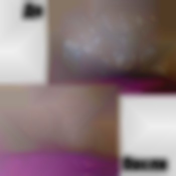 До/после

Зона"глубокое бикини"

Ваш мастер - кристина