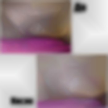 До/после
Зона"глубокое бикини"
Ваш мастер - кристина