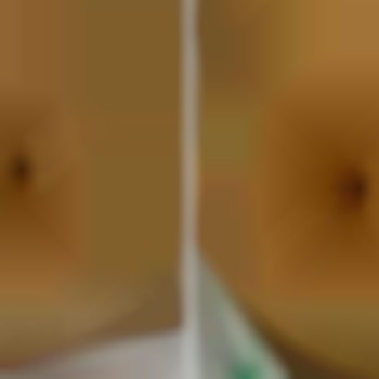 корекція фігури, лазерна епіляція