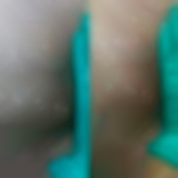 Первина депіляція, почервоніня сходить за пару годин. Головн