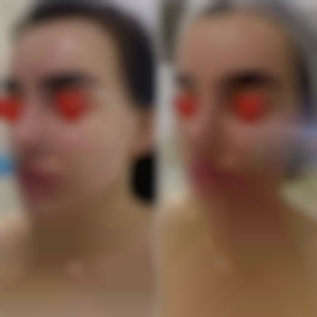 Скульптурирующий массаж лица