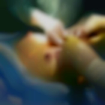 Мамопластика
                    Медичний центр ВВ Клиника Київ