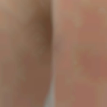 Результат чистки бикини