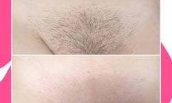 Депіляція воском/цукром глибокого бікіні Салон краси Мастерская Красоты "Юлии Юдиной" Київ