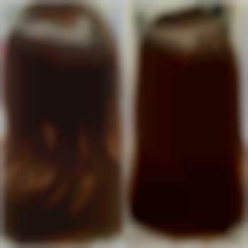 Биксипластия.