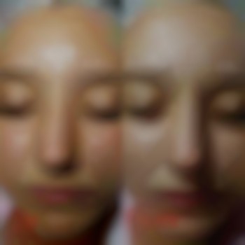 Чистка обличчя ( 12 років)