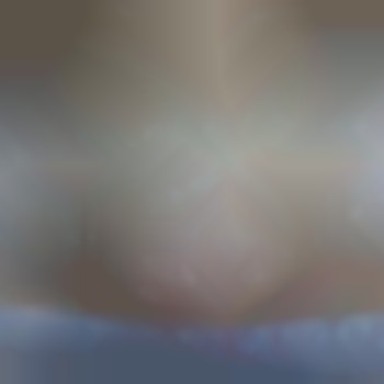 Зона бикини
Реакция кожи сразу после процедуры