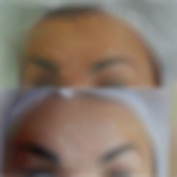 Лоб+ межбровка