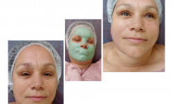 Комплексный уход лицо, шея, зона декольте Косметолог Оксана Київ