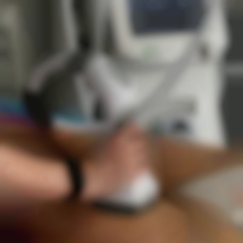 Корекція фігури на апараті Slimming IV