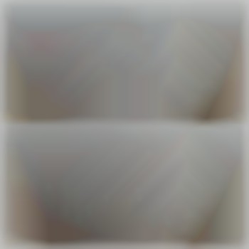 IPL епіляція