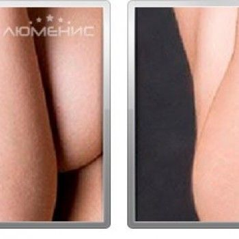 Фото з портфоліо салону Люменис (косметологічний центр, Львів)