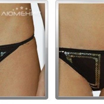 Фото з портфоліо салону Люменис (косметологічний центр, Львів)