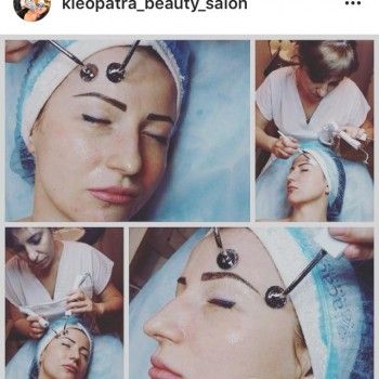 аппаратная косметология лица, уход за лицом, косметология лица
