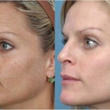 Фото с портфолио Avant`age