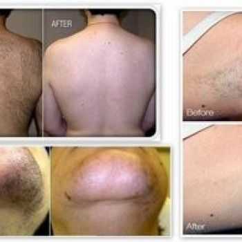 депиляция, лазерная эпиляция, оформление бровей, наращивание ресниц