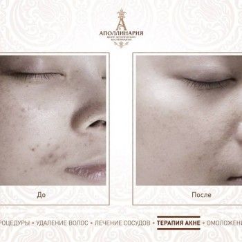 аппаратная косметология лица, уход за лицом, коррекция морщин, оформление бровей, наращивание ресниц, косметология лица
