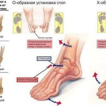Восточный рефлексогенный массаж стоп 
                     Центр коррекции позвоночника Евминова Одесса