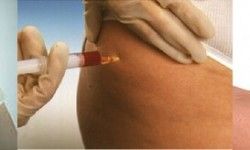 Озонотерапия волосистой части головы Косметологічний центр Plazamed Запоріжжя