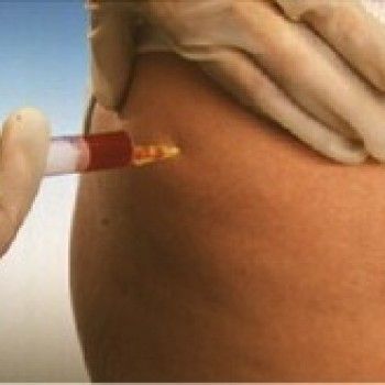 Озонотерапия лица полностью
                    Косметологічний центр Plazamed Запоріжжя
