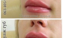 Татуаж губ Косметолог Дарья Пожилова Одеса