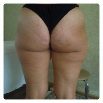 Фото с портфолио Татьяна Губка 