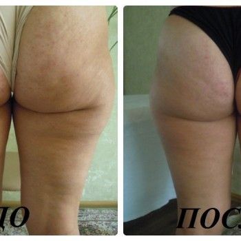 Фото с портфолио Татьяна Губка 