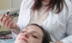 Пилинг Косметолог Екатерина Проценко Запоріжжя