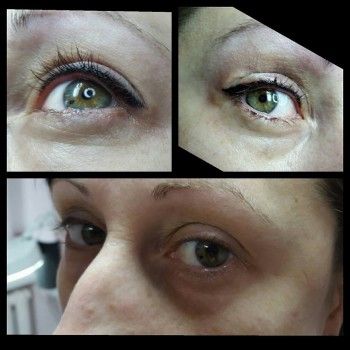 Наращивание ресниц
                    Студия татуажа Soft Touch Кривой Рог