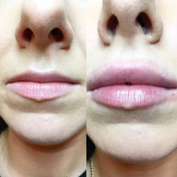 Фото с портфолио Анна косметолог 