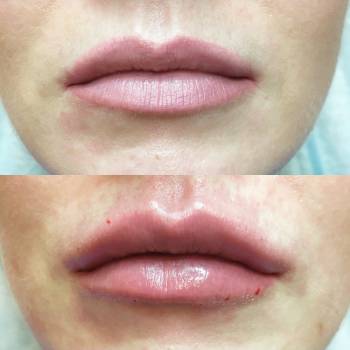 Фото с портфолио Анна косметолог 