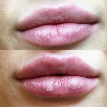 Фото с портфолио Анна косметолог 