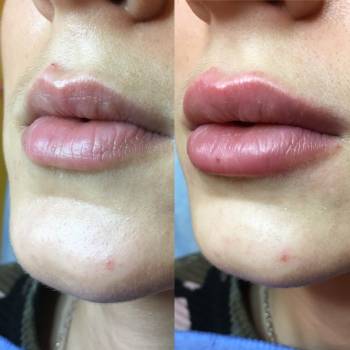 Фото с портфолио Анна косметолог 