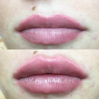 Фото с портфолио Анна косметолог 