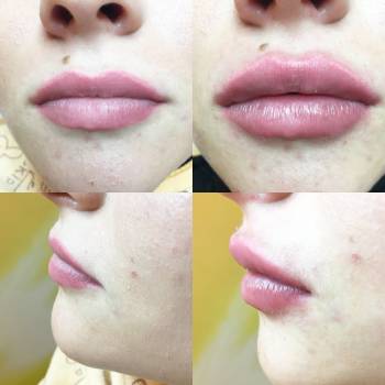 Фото с портфолио Анна косметолог 