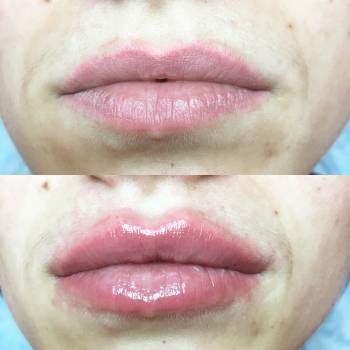 Фото с портфолио Анна косметолог 