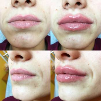 Фото с портфолио Анна косметолог 