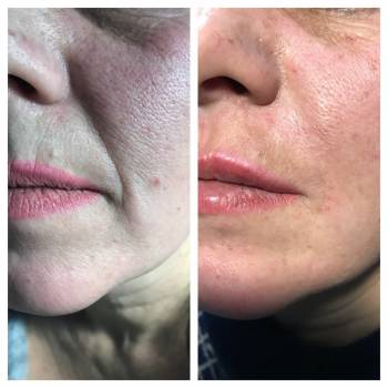 Виктория Чистенко , Запоріжжя Фото - 5