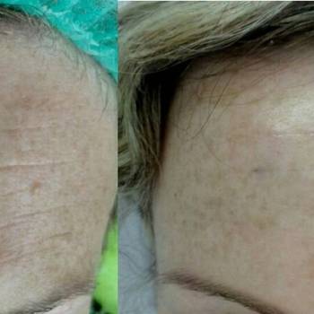 Виктория Чистенко , Запоріжжя Фото - 8