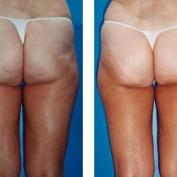 Фото с портфолио Beauty Ann