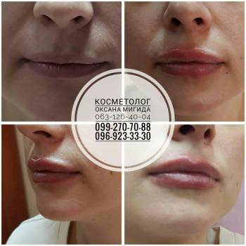 Оксана Мигида , Миколаїв Фото - 8