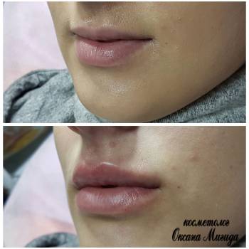 Оксана Мигида , Миколаїв Фото - 13