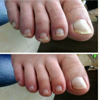 Анна Башмакова, Одеса Фото - 31