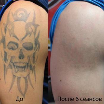 Glazur, Киев Фото - 22